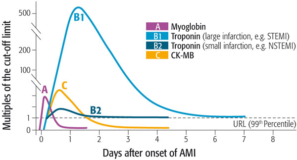 Myo-Il primo in modo anomalo aumento cardiaco proteine marcatore dopo un infortunio del miocardio